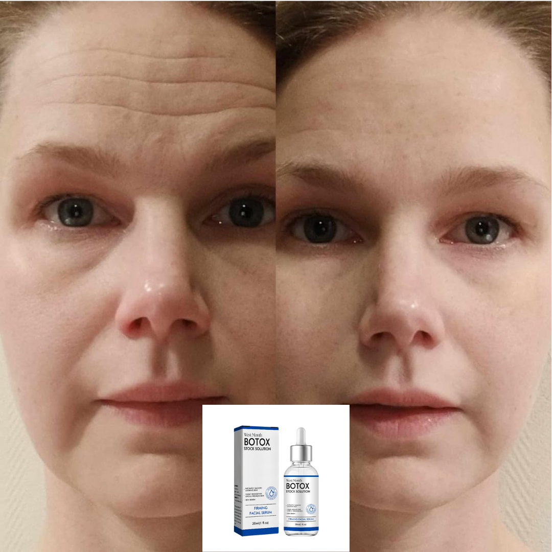 DreamSkin®- Botox gezicht serum - Anti-rimpel